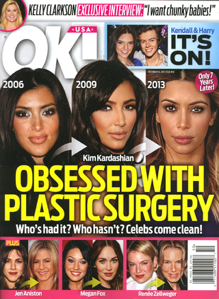 Illustration for article titled This Week in Tabloids: A Detailed Analysis of Ke$ha's Plastic Surgery